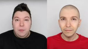 2 Years Weight Loss Journey Of A Youtuber